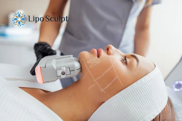 HIFU vs Botulinum Toxin: Understanding the Differences 1 HIFU vs Botox Dorchester What is the best option for you?