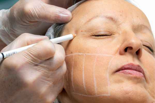CryoPen: 5 Skin Concerns It May Be Used to Treat 4 What should you ask before having CryoPen treatment Dorchester?