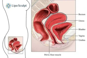 Treatment For A Leaky Bladder 2 How EM Chair treatment Dorchester can help Leaky bladder issues. Read more now!